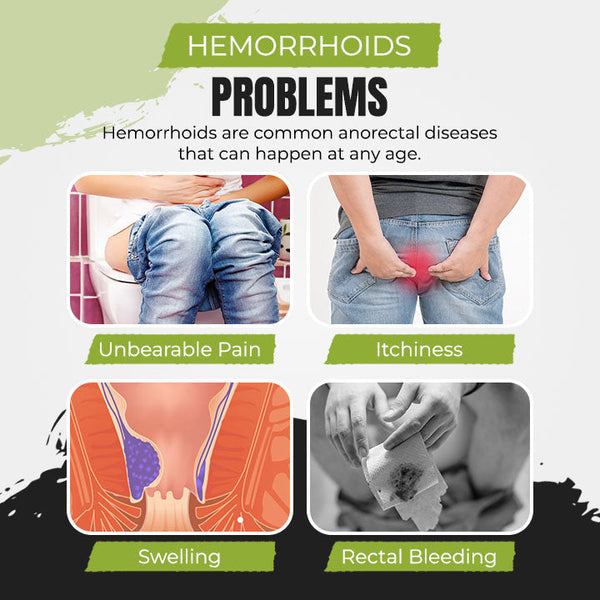No.1 Hemorrhoids Treatment Spray