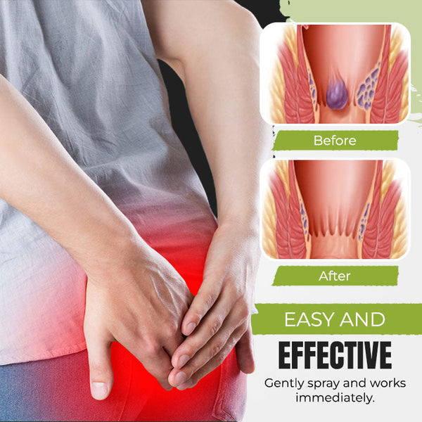 No.1 Hemorrhoids Treatment Spray