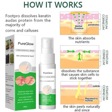 PureGlow™ Corn Remover Power Spray (New P)