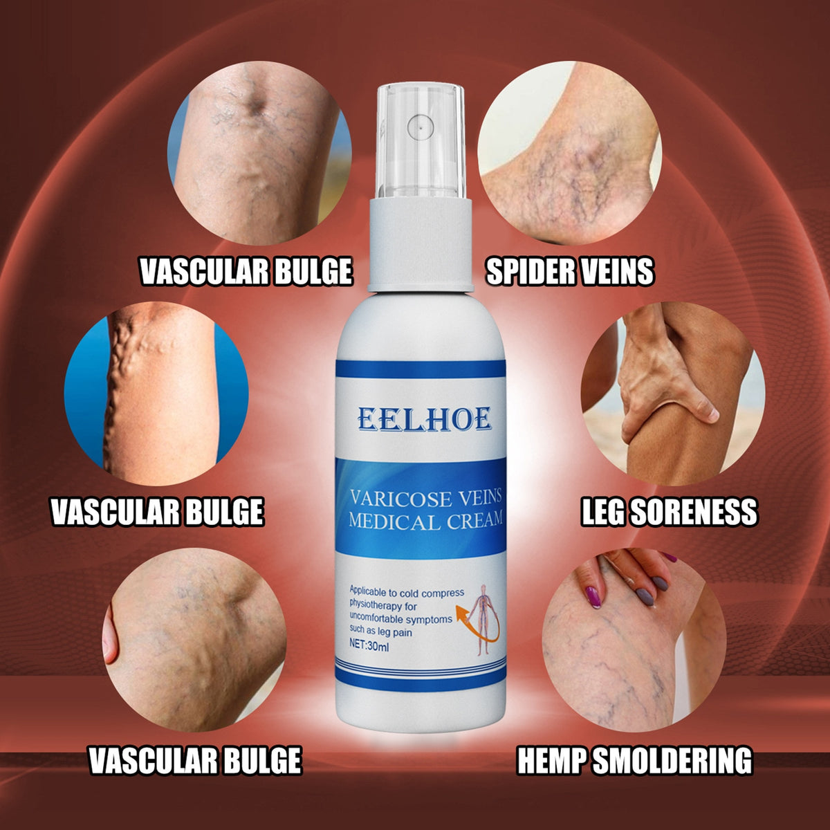 Vein Treatment Varicose Vein Treatment Spray, Leg Varicose Vein Treatment