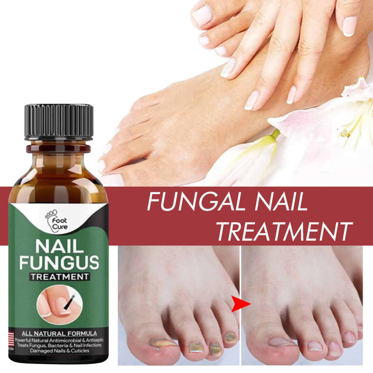 10ml Oil for Nail Fungus
