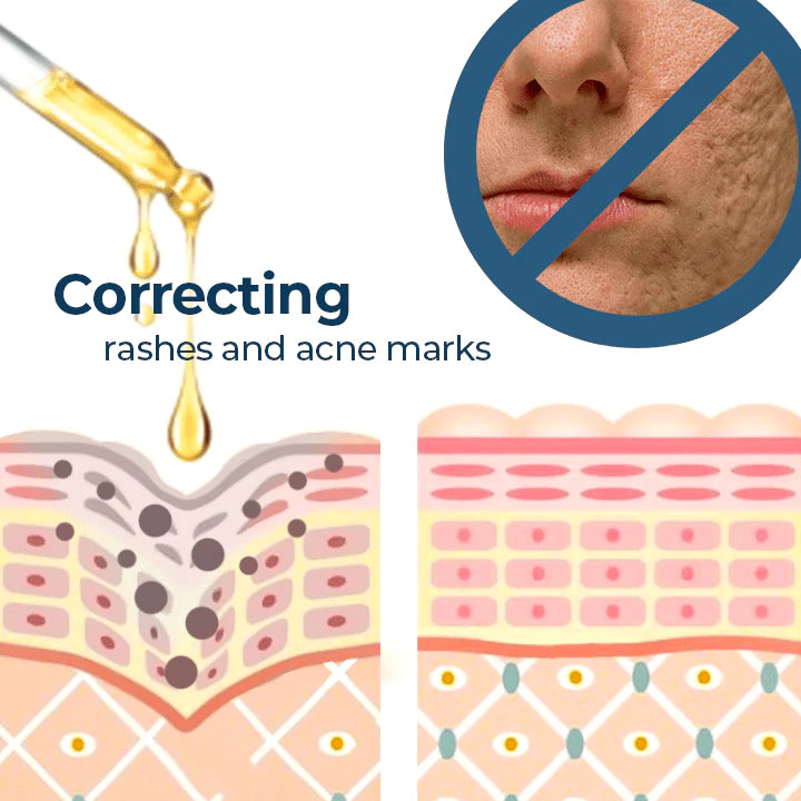 Turmeric Oil For Dark Spot And Wrinkles