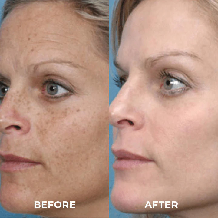 Turmeric Oil For Dark Spot And Wrinkles