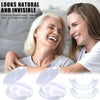 Snap On Smile Veneers Moldable False Teeth Kit for Men & Women