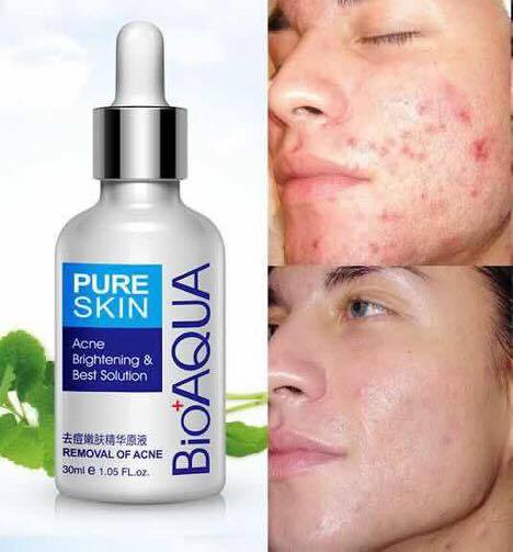 BIO AQUA ACNE REMOVAL CREAM