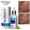 BIO AQUA ACNE REMOVAL CREAM