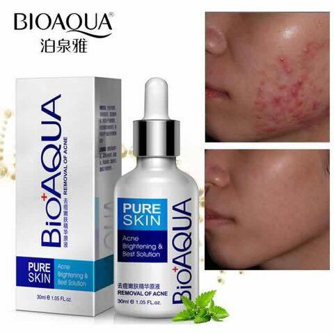BIO AQUA ACNE REMOVAL CREAM