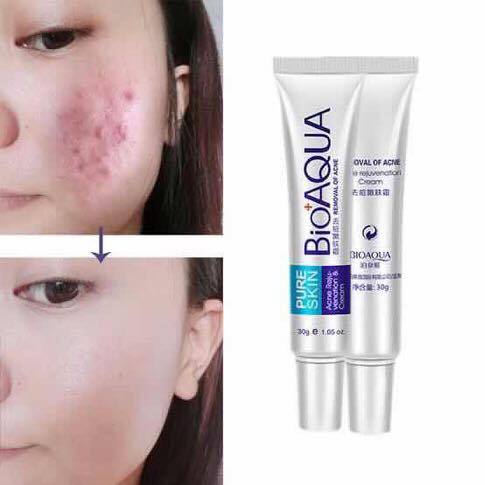 BIO AQUA ACNE REMOVAL CREAM