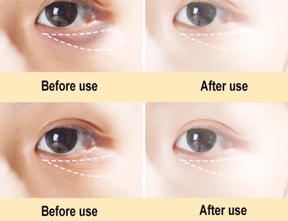 Dr.rashel Anti-Wrinkle Eye Mask for Eye