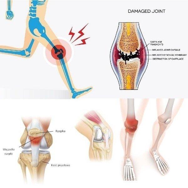 Healing Knee Plaster