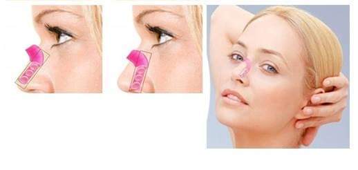 Amazing Nose Shaper ( Pack of 3)