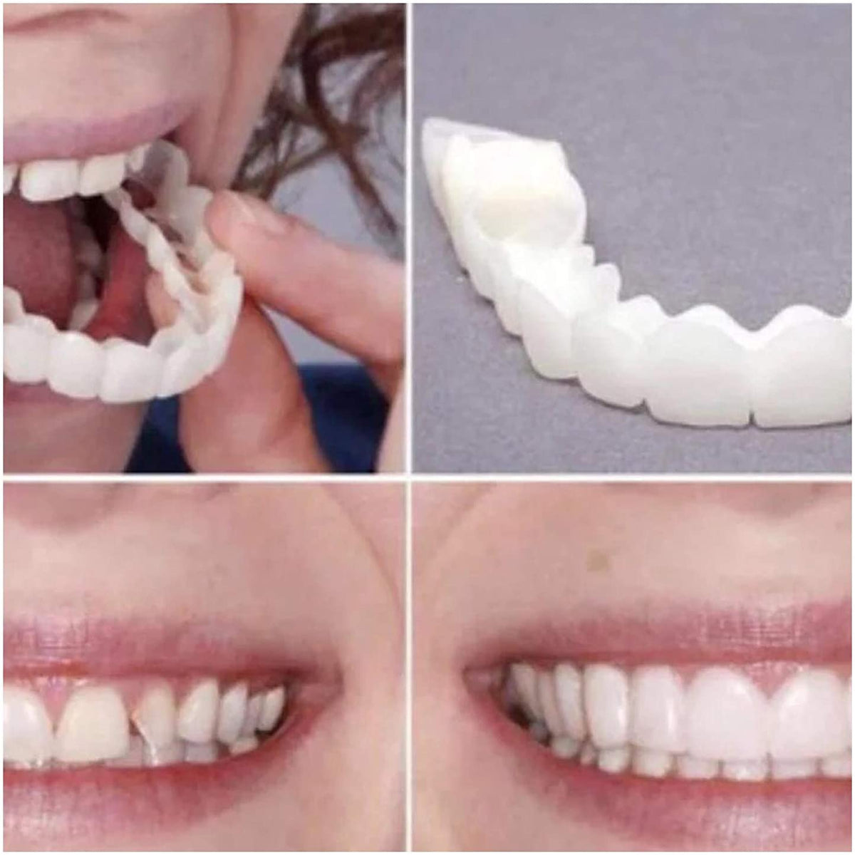 Denture Teeth Temporary Fake Teeth for Snap on Instant & Confidence Smile